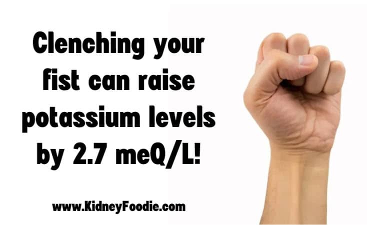 fist clenching, ckd, and pseudohyperkalemia